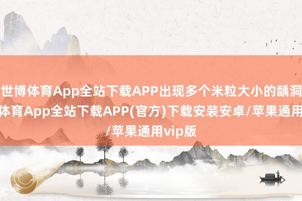 世博体育App全站下载APP出现多个米粒大小的龋洞-世博体育App全站下载APP(官方)下载安装安卓/苹果通用vip版
